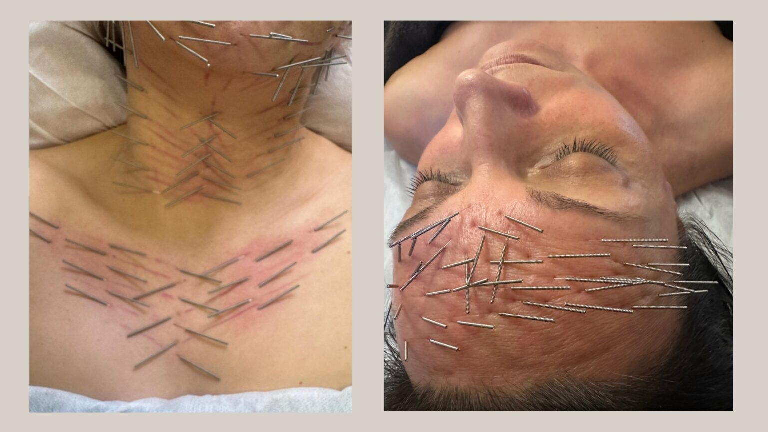 Kompleksowa Terapia Twarzy - 17