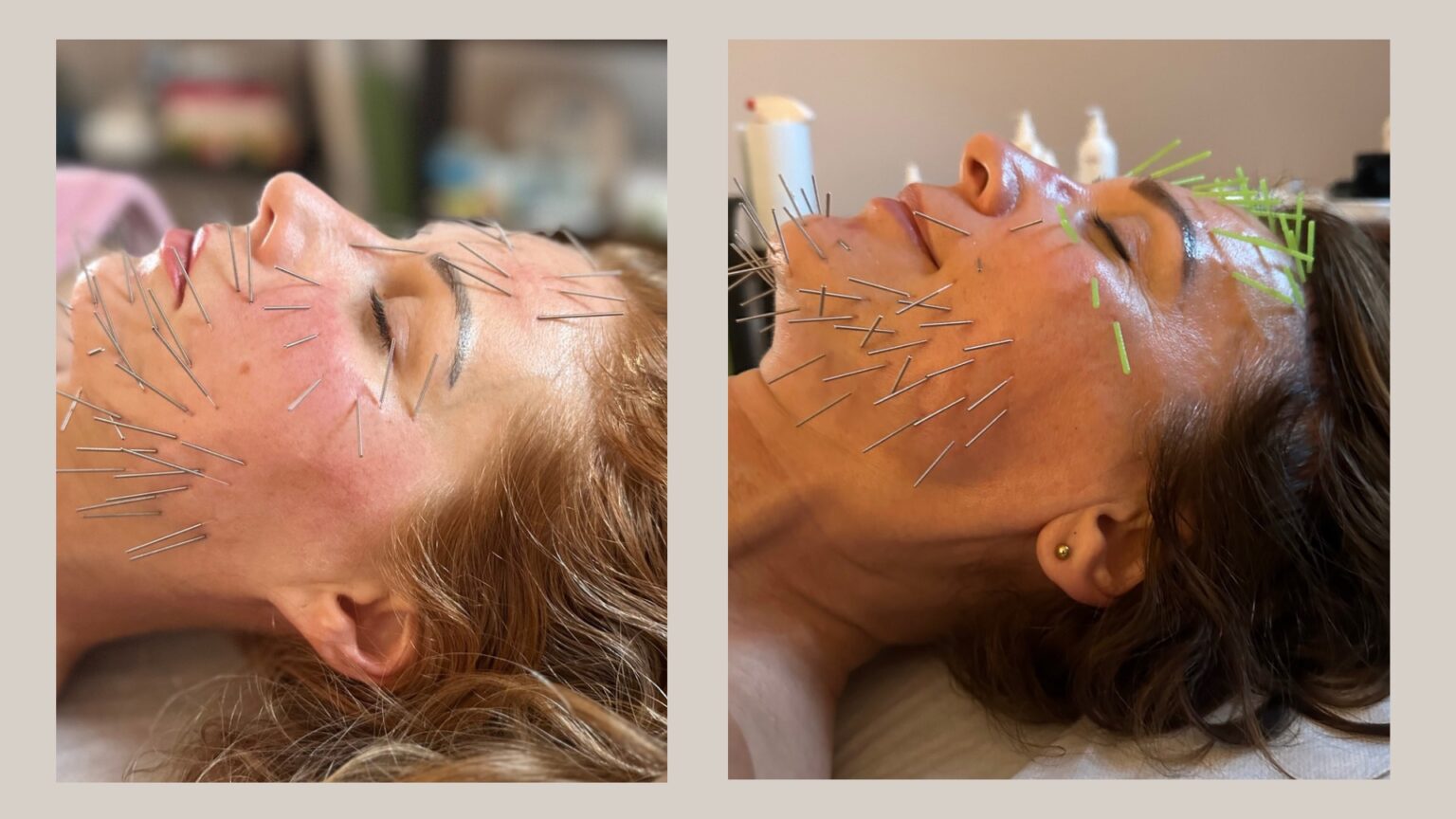 Kompleksowa Terapia Twarzy - 18